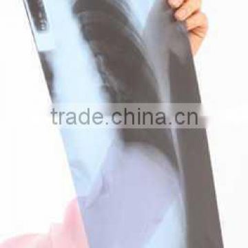 made in china ct film, x ray glass,printer can, thermal photo printers china