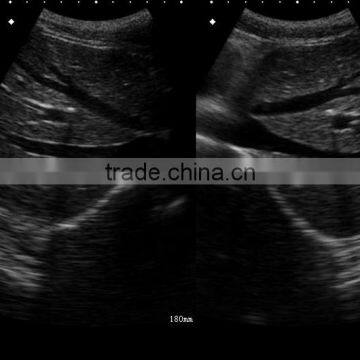 UProbe-20 Probe Type Ultrasound Scanner for Laptop photo-5