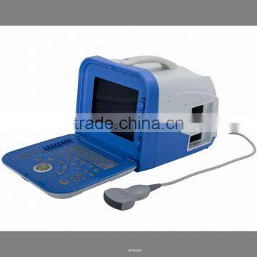 Digital portable ultrasound scanner WT-51353A