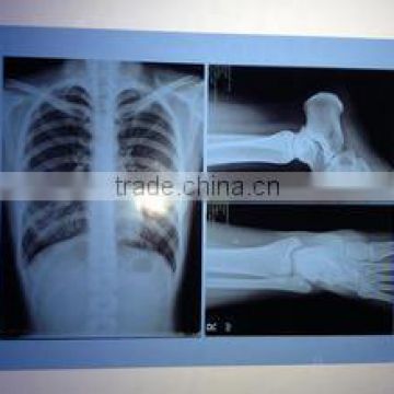 film suitable for hospital x- ray/ dry /thermal / medical film blue film green film