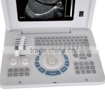Hospital Full-digital Cheap Battery Diagnosis Equipment Laptop Ultrasound 3018