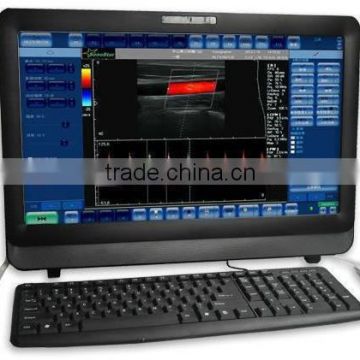 MC-DU-C8 22 inch Touch Screen Laptop Color Doppler Ultrasound System