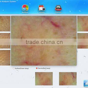 Newest Handheld Skin Analyzer