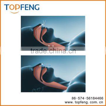 Nose Breathing Apparatuss photo-2