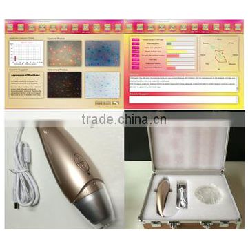 AYJ-J016 beauty salon equipment Portable Intelligent Digital Skin Analyzer 3d