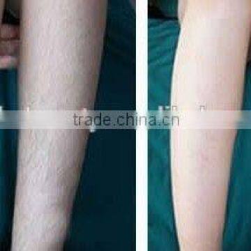 Ipl Laser Treatment for Hair Removal/mini Home Ipl Hair Removal Machine photo-6