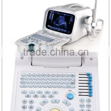 Professional Portable Ultrasound Scanner Ultrasonic machine multi-frequency probe