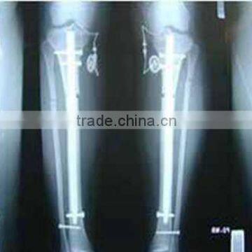 Used medical x-ray equipment,china medical x-ray film fuji type KND film with CE