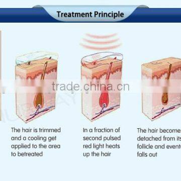 10.4 Inch Touch Color Screen High Power Professional and Effective Permanent Unhairing Portable 808nm Diode Laser photo-3
