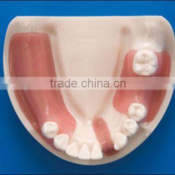 dental equipment teaching implant tooth model standard size teeth model