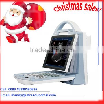 MSLCU23M, Christmas sales portable color ultrasound machines / laptop ultrasound machines