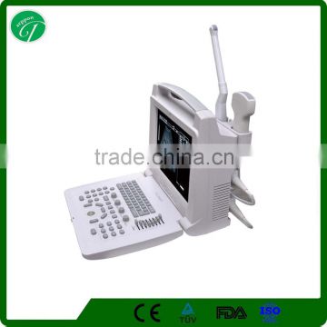 imported 12 " LCD Handled USB B Ultrasound machine in white color