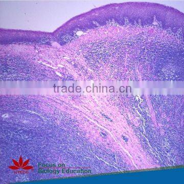 Individual Slides You Can Choose From Survey Medical Human Pathology Histology Tissue Microscope Prepared Slides photo-5