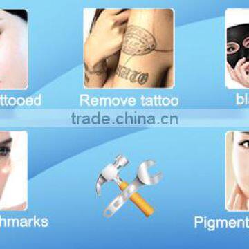 Top One Portable Dark Spot Removal Machine/ nd Yag Laser (CE)/all Color Tattoo Solution Lower Injure Q-switch nd Yag Laser