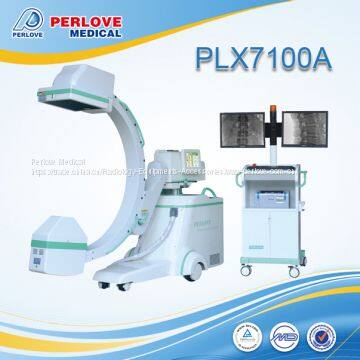 25kw C-arm machine PLX7100A for cervical spine immobilization