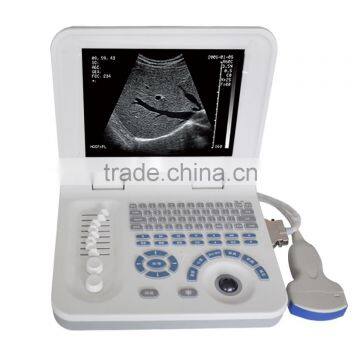 Hospital Full-digital Cheap Battery Diagnosis Equipment Laptop Ultrasound 3018