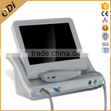 8MHz New Machine 2016! Wrinkle Remover HIFU High-intensity Ultrasound Forehead Wrinkle Removal