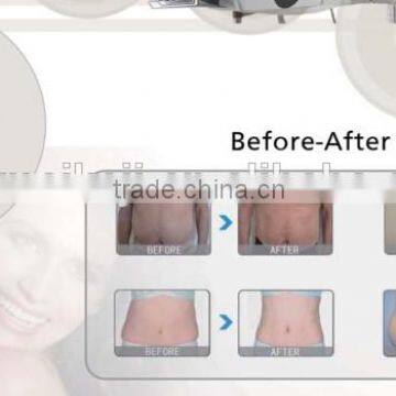 Lipolaser Slimming Machine Loss Weight and Cavitation Machine photo-3