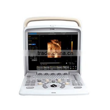 FM-580 Hospital 4D Gynecology Color Doppler CE approved