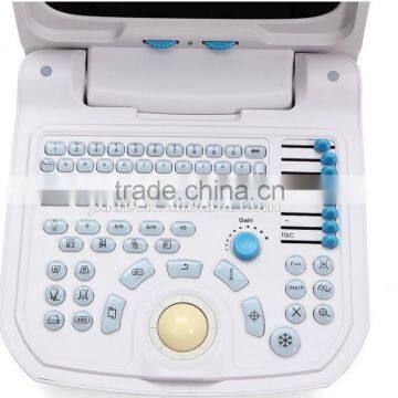 2016 High Quality Digital Portable PC Based Veterinary Ultrasound Scanner for Dog & Pig Pregnancy photo-2