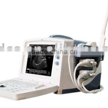 Diagnostic Ultrasound System