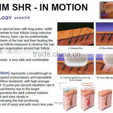 Permanent 808nm Diode Laser Bode Hair Removal With No Pain Arm / Chest Hair Removal photo-3