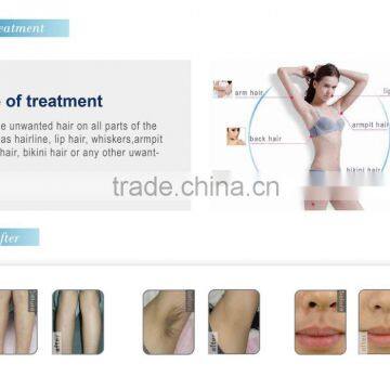 1-10HZ Newest 808nm Diode Laser Face Hair Removal Machine/810nm Portable Laser photo-4