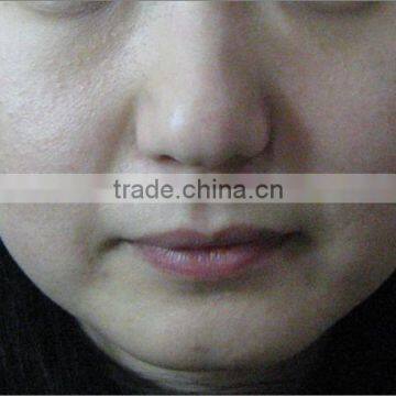 Non-surgical No-wound Hifu Anti-aging Face Lift Machine With 3 Cartridge Different Treatment photo-4