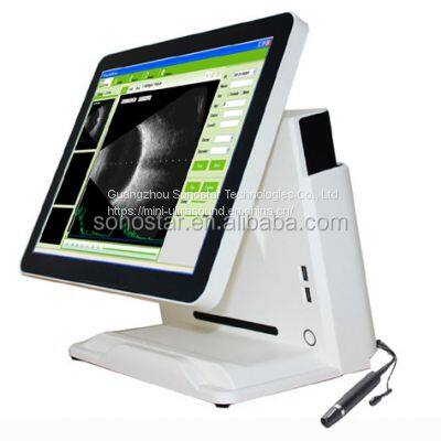 Cheapest best selling portable eye B ultrasound scanner a B equipment