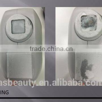 OEM Depilation Machine/808 Diode Laser Hair Removal photo-4