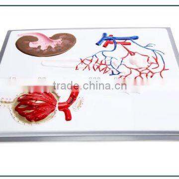 Nephron, Renal Corpuscle Model Demonstration Teaching Biological Science Instruments for Middle School Students photo-3