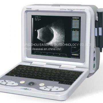 Ophthalmic A/B Scanner Medical Diagnosis Equipment with USB and Mouse Port Ultrasound