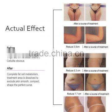 Beauty Salon Use Ultrasound Shap Fat Removal With CE Certificate photo-6