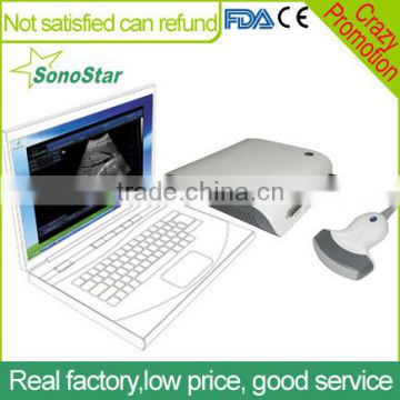 Sonostar Portable Ultrasound Equipment ultrasound 4D ultrasound box with High Quality UBox-10