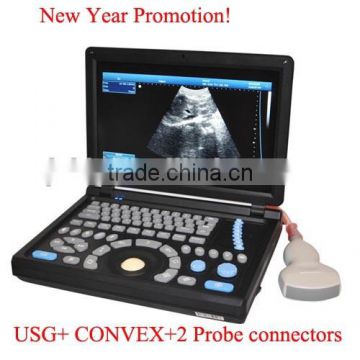 Promotion!!CE approved Notebook Ultrasound Scanner with 3.5Mhz multi-frequency convex probe RUS-9000E2