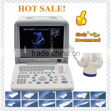 2016 Large Screen LED Hot Sale Portable Ultrasounic Diagnose Scanner Machine System with 2 Probe/Transducer Connector