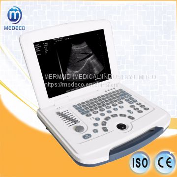 Me-580 Ultrasound Machine Digital Ultrasound Diagnostic