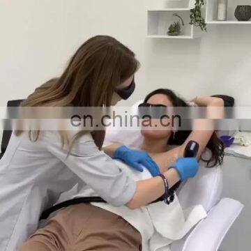 Germany Dials 755 810 1064 Hair Removal / Alexandrite Diode Laser Hair Removal