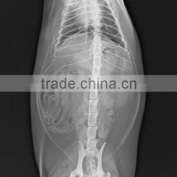 China KND-A/F CE medical dry film radiografia de vias digestivas altas