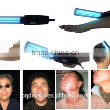 Home Use Portable UV Phototherapy 311nm Narrow Band Uvb Lamp for Psoriasis Treatment Vitiligo Treatment photo-3