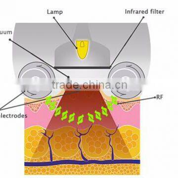 Kumashape Safe and Enjoyable Slimming IR RF Vacuum Rolling Massage Beauty Device