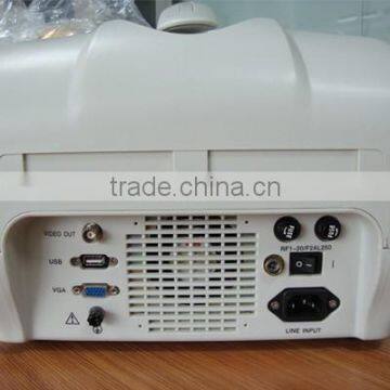 CE Approved Portable Ultrasound Scanner With 3.5Mhz Multi-frequency Convex Probe RUS-6000A photo-3