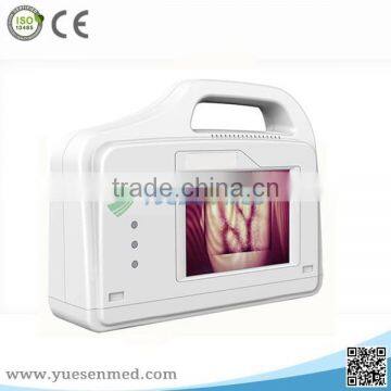 Factory Price Advanced Patent Technology Portable Vein Finer photo-3