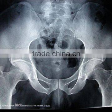 China KND-A/F CE Medical Dry Film Agfa Healthcare photo-2