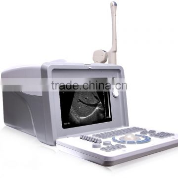 MCB-18C Digital Portable Ultrasound Scanner