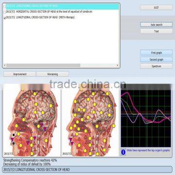 2017 Factory Health Analyzer 9DNLS Body Nls Diagnostic System photo-5