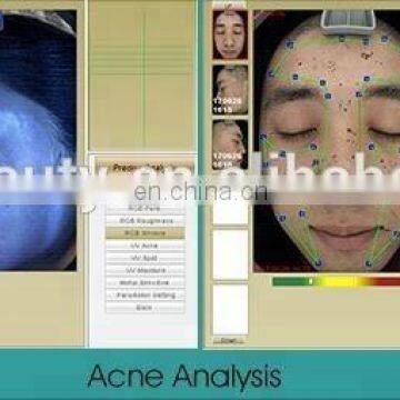 Multi Function Light Facial Skin Analysis Machine for Skin Sensitiveness And Age Test