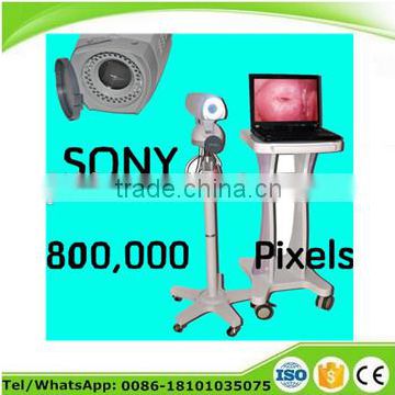 Digital High-Pixel Electronic Video Colposcope with 800,000 / 1,000,000 pixels