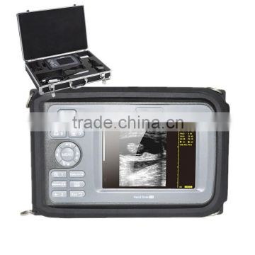 cheap price Portable Ultrasound scanner with battery aluminium box suitable hospital clinic