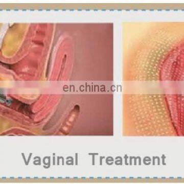 Rf Tube Vagina Tightening CO2 Fractional Laser Scar Acne Removal Machine photo-7